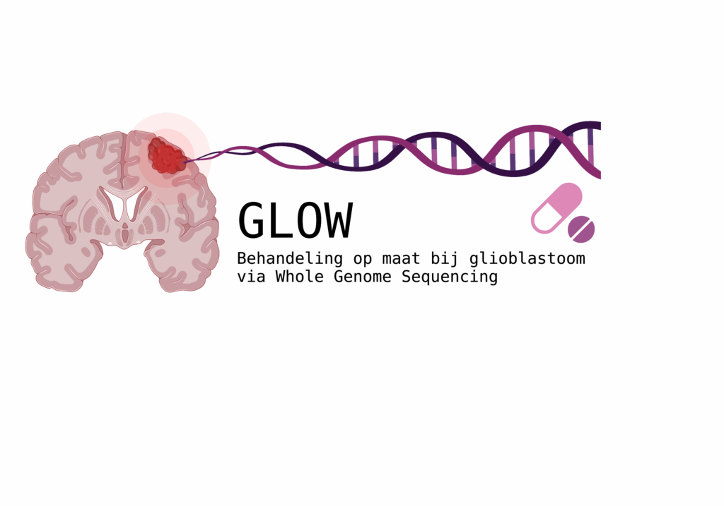 GLOW-studie eindigt – maar WGS blijft waardevol voor patiënten met glioblastoom 